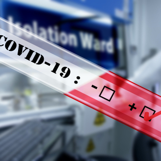 Documentos para el seguimiento, vigilancia y control de COVID-19