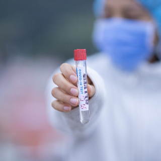 Qué debe hacer el dentista si ha estado en contacto con un positivo de SARS-CoV-2